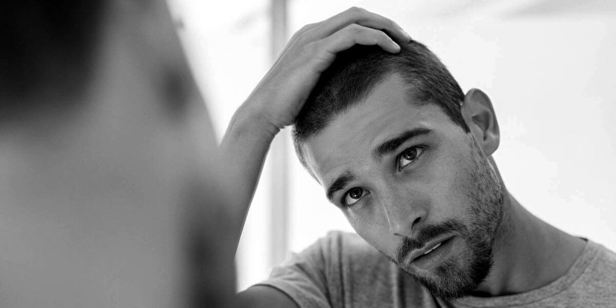 Qual o melhor tratamento para a calvície?