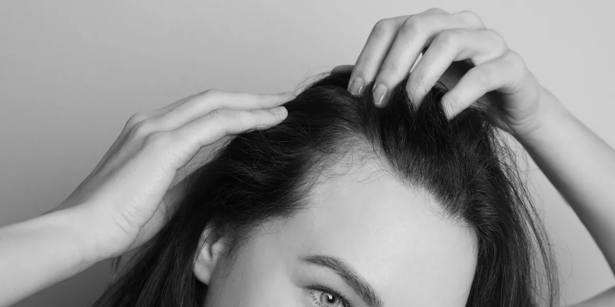 No momento, você está visualizando Cabelos finos: é a química ou calvície?