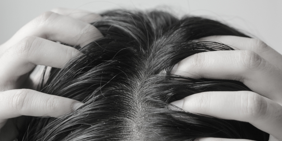 Coceira no Couro Cabeludo: Causas Comuns e Alívio com Tratamento Dermatológico 